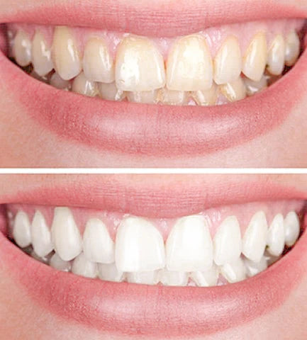 Clareador Dental Viya White