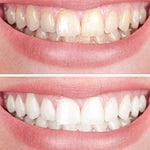 Clareador Dental Viya White