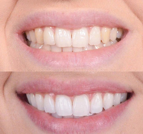 Clareador Dental Viya White