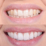 Clareador Dental Viya White