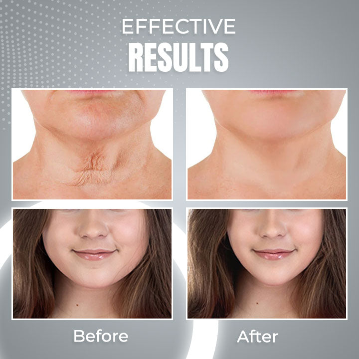 ViyaSkin® Dispositivo de contorno facial anti-idade