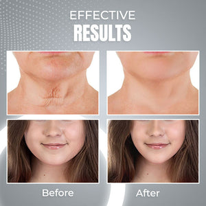 ViyaSkin® Dispositivo de contorno facial anti-idade