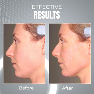 ViyaSkin® Dispositivo de contorno facial anti-idade