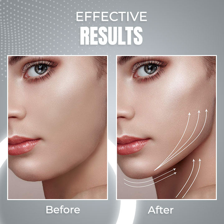 ViyaSkin® Dispositivo de contorno facial anti-idade