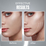 ViyaSkin® Dispositivo de contorno facial anti-idade