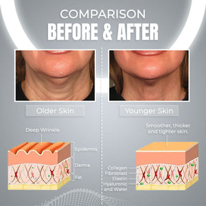 ViyaSkin® Dispositivo de contorno facial anti-idade