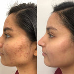 Serum Facial de Flor de Cerejeira – Pele Iluminada