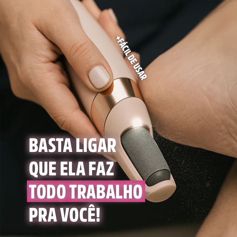 Removedor de Calos e Rachaduras dos Pés - Soft