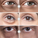 Sérum Rejuvenescedor Anti Rugas e Olheiras – Radiant Eyes
