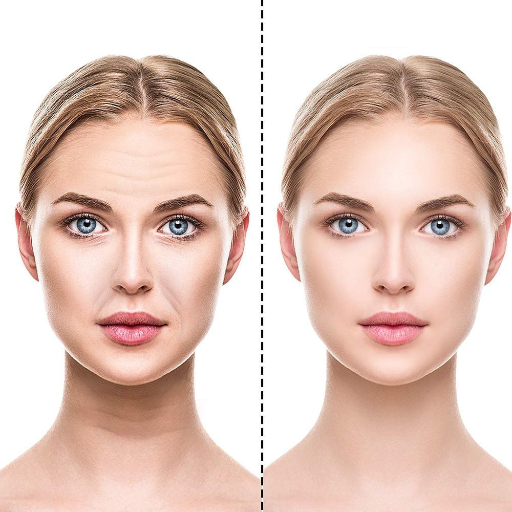 Adesivos de Silicone Anti Rugas e Linhas de Expressão - RevonaSkin™ - Elfmaeve