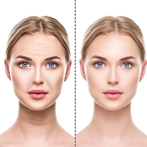 Adesivos de Silicone Anti Rugas e Linhas de Expressão - RevonaSkin™ - Elfmaeve
