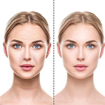 Adesivos de Silicone Anti Rugas e Linhas de Expressão - RevonaSkin™