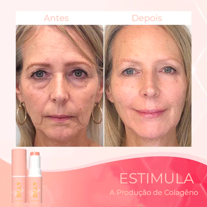 Creme Rejuvenescedor Anti-Age - Anti Manchas & Expressões™ - Elfmaeve