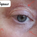 Sérum Rejuvenescedor Anti Rugas e Olheiras – Radiant Eyes