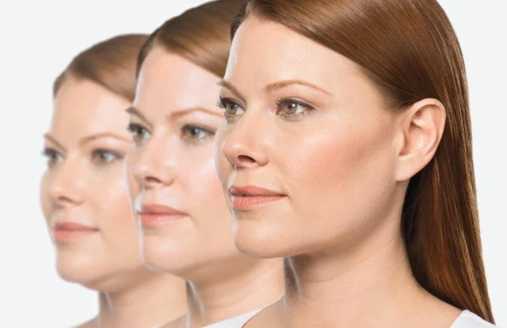 Massageador Instant Lifting - Removedor de papada