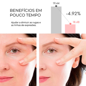 Creme Rejuvenescedor Anti-Age - Anti Manchas & Expressões™ - Elfmaeve