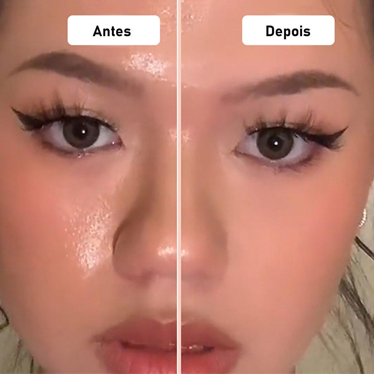 Massageador e Removedor de Oleosidade da Pele - Oiless Skin