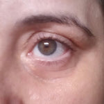 Sérum Rejuvenescedor Anti Rugas e Olheiras – Radiant Eyes